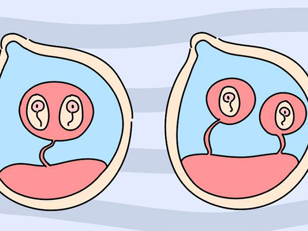 38岁试管双胎妊娠风险大吗？