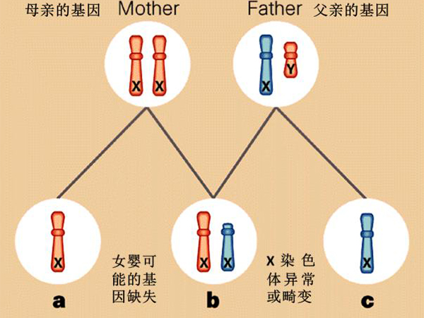 特纳症打生长激素有快速长胖的反应吗？