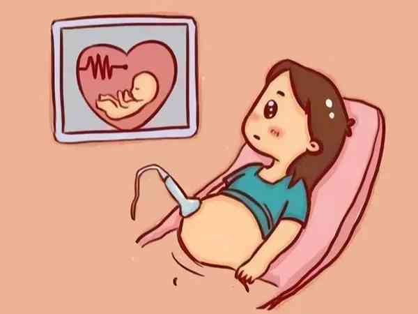 胎心监护卡通图图片