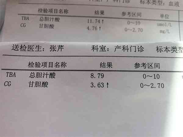盛京医院产检时孕妇为什么要查甘胆酸？