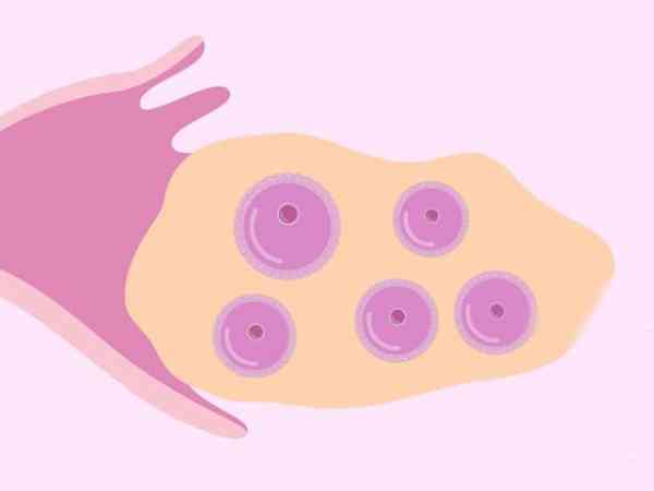 去武汉同济监测卵泡是挂生殖医学科吗？