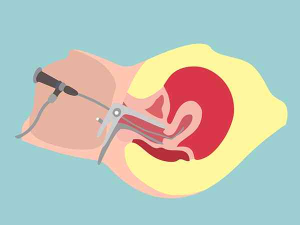 生化妊娠一周多还有月经量的出血正常吗？