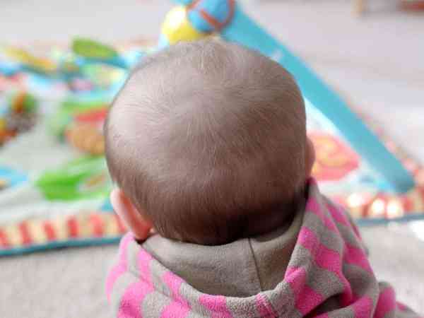宝宝后脑勺头发稀少、泛白是缺乏微量元素吗？