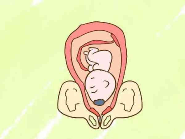 孕晚期尿隐血、细菌多、胎头浅入盆正常吗？