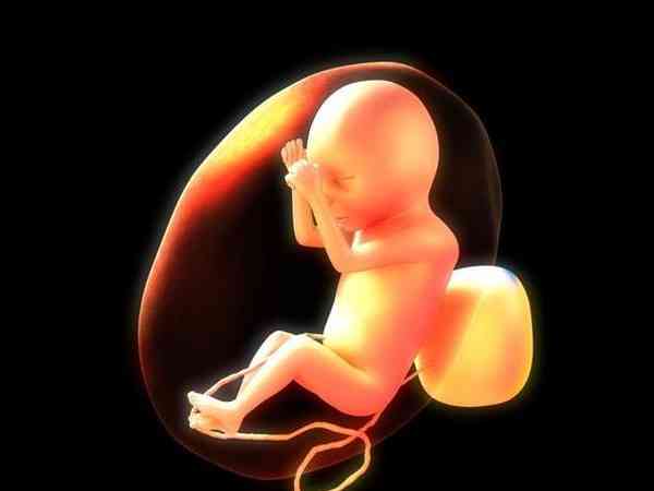 宫腔积液会引起胎停或是胎儿发育畸形吗？