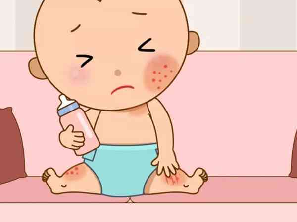2岁宝宝脸上长湿疹日常怎么护理比较好？