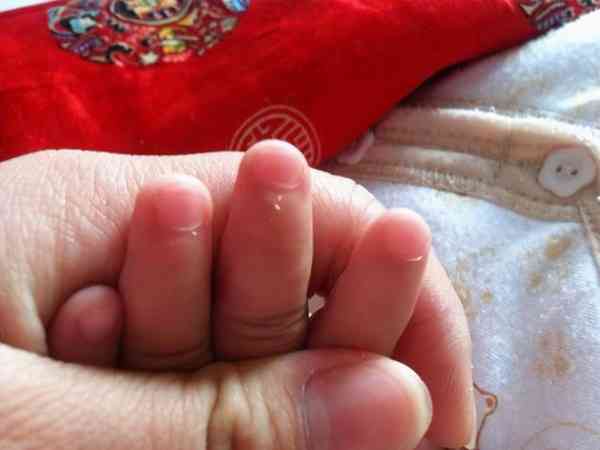 6个月宝宝手指长倒刺是不是缺锌和维生素？