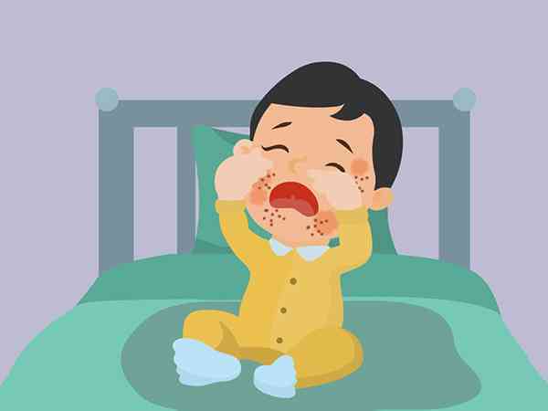 小孩嘴巴里长疱疹但不发烧一定是疱疹性咽峡炎吗？