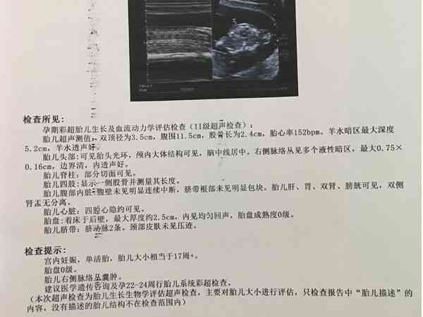 孕26周左侧脉络丛囊肿，脑室偏大会影响胎儿智力吗？
