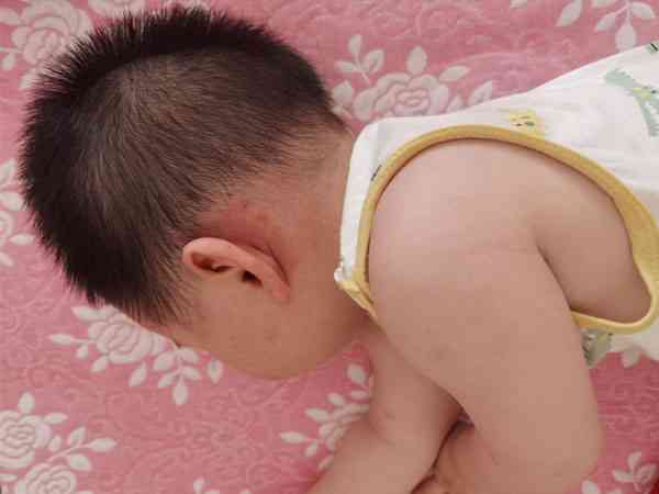 9个月宝宝起疹子高烧39°是打麻腮风疫苗的常见反应吗？