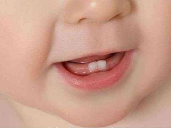 宝宝口水疹严重，除了涂抹百多邦还应该怎么处理？