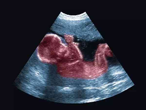 怀孕23周胎儿真实图片图片