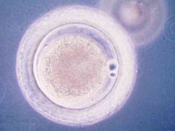 囊胚是不是已经决定生男生女了？