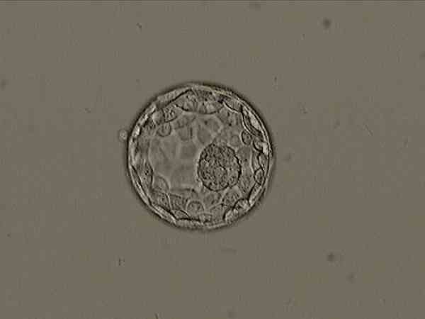 5天的3bb囊胚是几级胚胎？