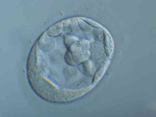 囊胚4bc几乎是女孩是真的吗？