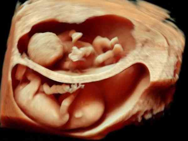 4aa囊胚会分裂变成双胎的几率大吗？