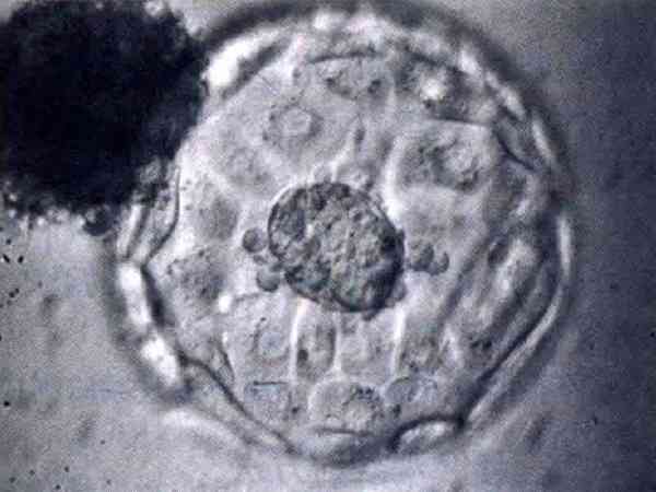 三级胚胎发育不好是精子差的原因吗？