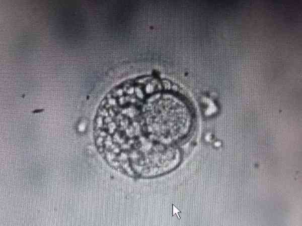 鲜胚三级八细胞胚胎质量好吗？
