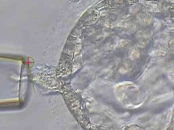 囊胚级别与成功率排列表中3AA囊胚成功率有多少？