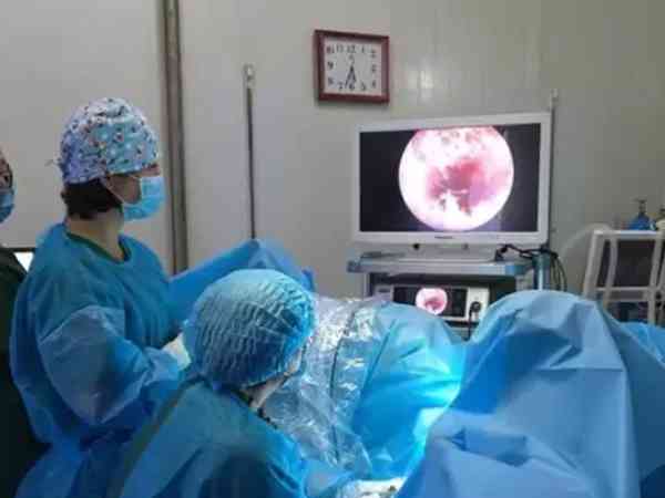 有没有宫腔镜手术全过程的详细操作流程？