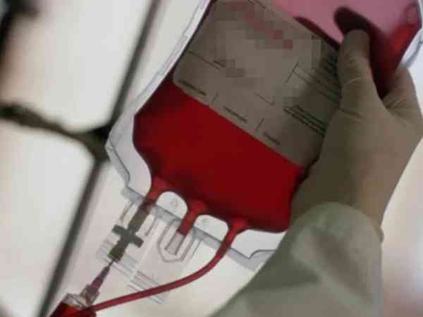 孟买血型在世界最稀有的血型排名中排第几？