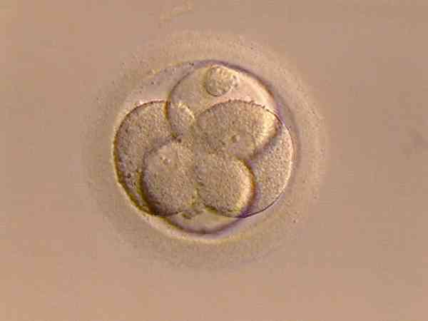 女性身体满足什么条件可以移植鲜胚？