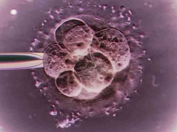 第三天什么样的胚胎医生会建议养囊？