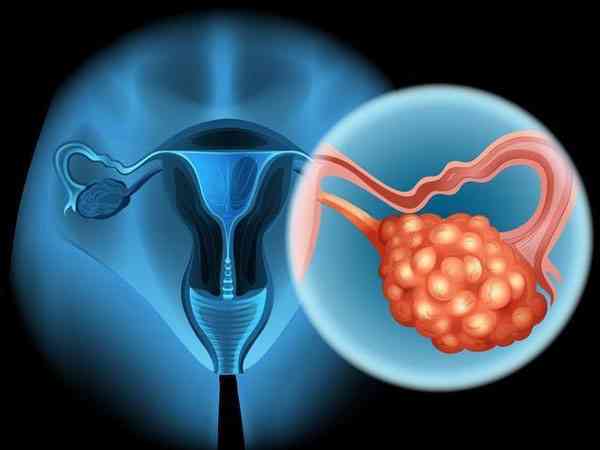 30岁女性无子宫有卵巢的情况下还能生育吗？