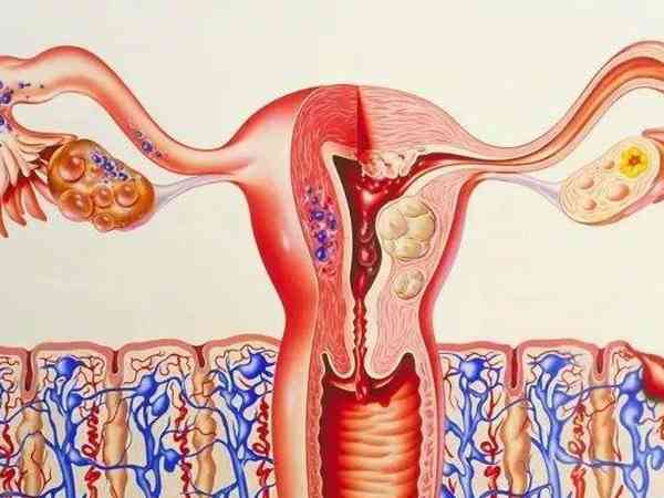 子宫形态不好做试管影响移植后胚胎着床吗？