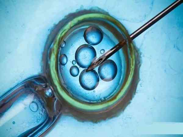 试管实验室的医生能看出来囊胚的性别吗？