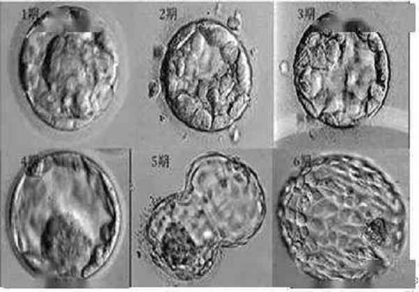 10c、9c、8c等级的胚胎哪个好？