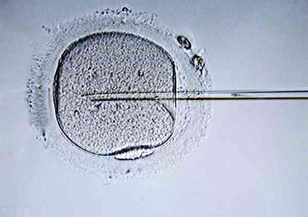 养囊的姐妹能说下6bc的囊胚和4bc哪个好吗？