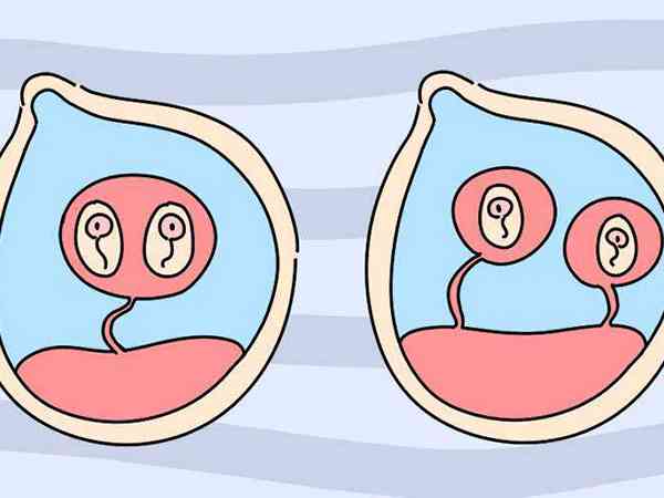 佳音医院做试管婴儿双胞胎和龙凤胎哪个几率大？