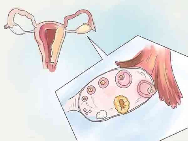  孕早期抽血检查雌二醇需要空腹吗？
