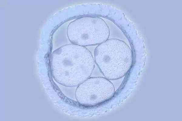 试管短方案取卵后轻微腹水当月能进行鲜胚移植吗？