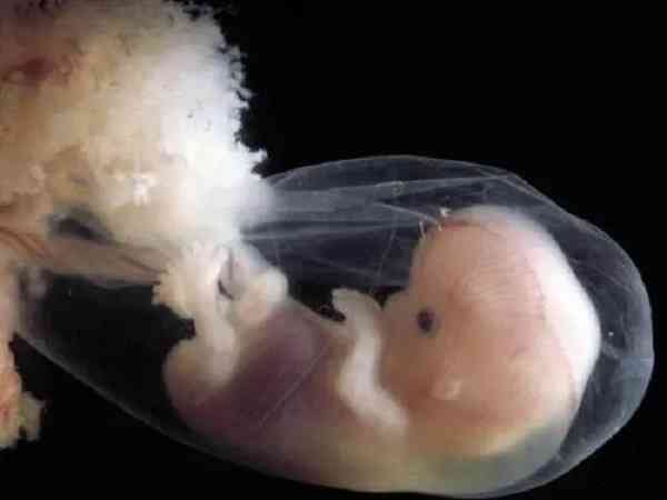 30岁以上的宝妈用清宫表测胎儿性别有不准的吗？