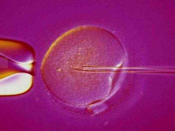 怎么从移植鲜胚后的一超数据中看生男生女？