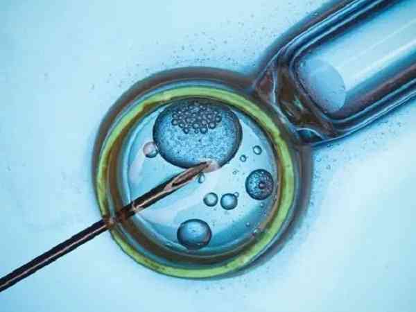 黄体期促排卵方案移植成功案例多吗？