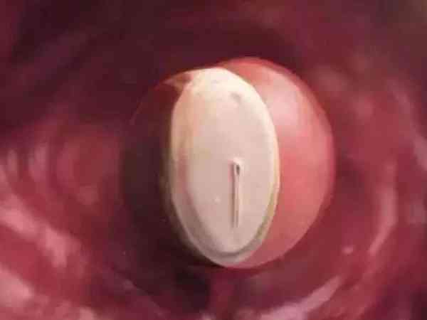 4ab属于几级胚胎？算优质囊胚吗？