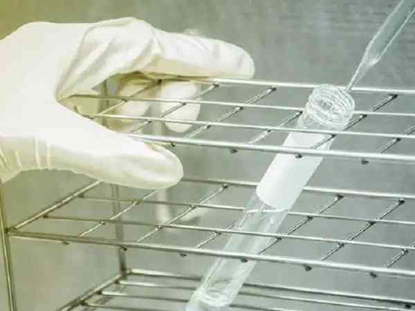 人工授精精子洗涤是怎么做的优化处理啊？