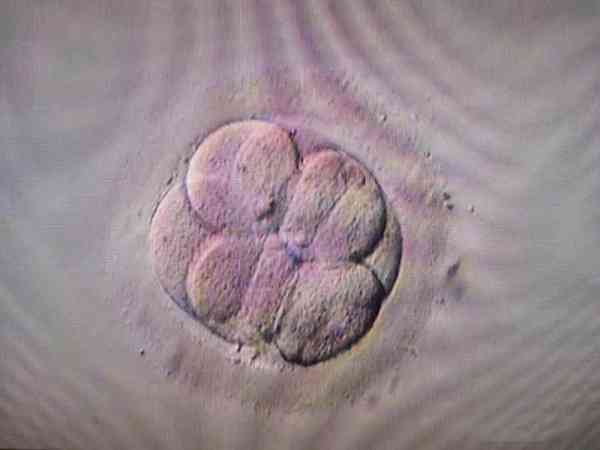 三天的胚胎6c4质量好吗？能不能移？