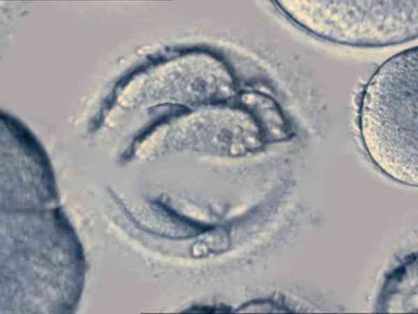 三天12细胞胚胎是什么等级？属于优胚吗？