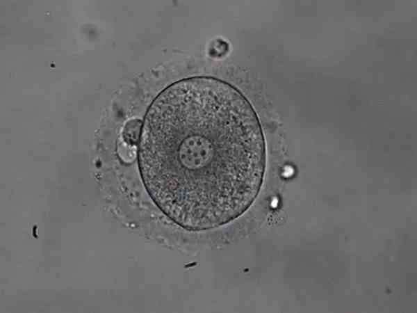 第五天的1PN的4BB囊胚能移植吗？