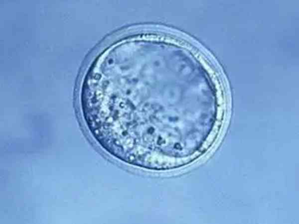 囊胚opn移植后必须要做羊水穿刺吗？
