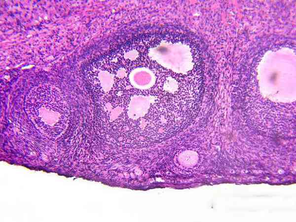 左右卵巢一共13个卵泡正常吗？