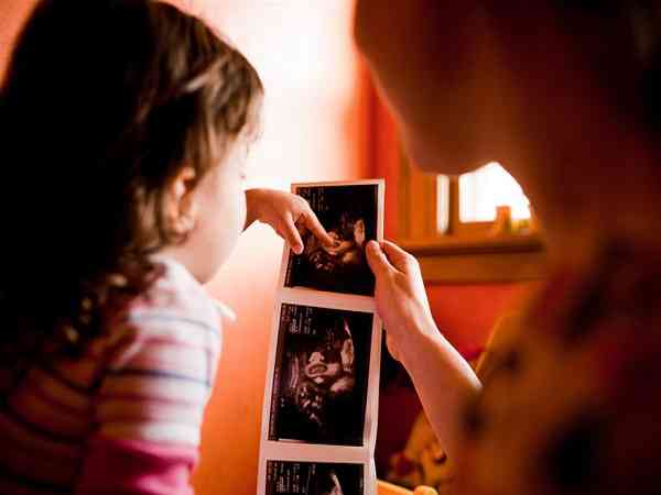 已生女儿的宝妈们12周nt检查图片有哪些特征？
