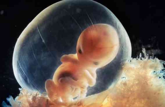 移植失败后胚胎排出来的样子是怎样的？有图片吗？
