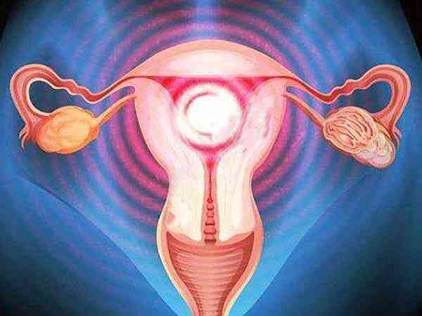 子宫腺肌症做试管的步骤是怎样的？