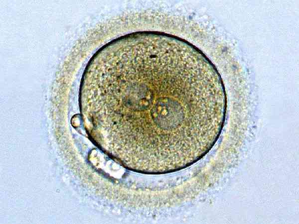 有养囊全部失败但是移植冻胚成功的案例吗？