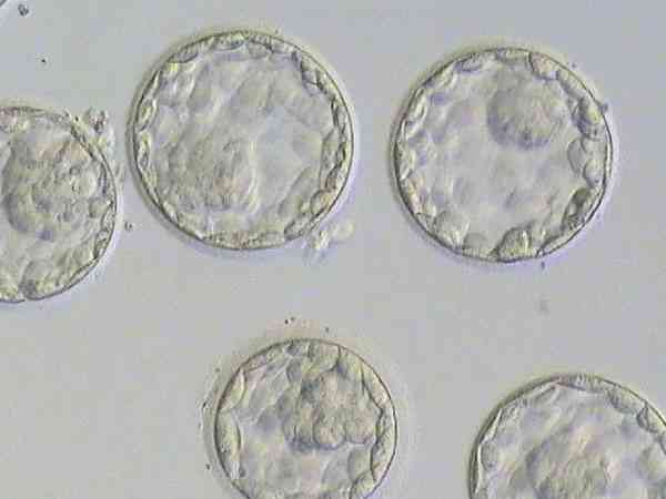 为什么三代规定放一个囊胚不能放两个？